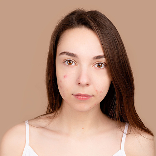 Correcci� facial en fotos de carnet